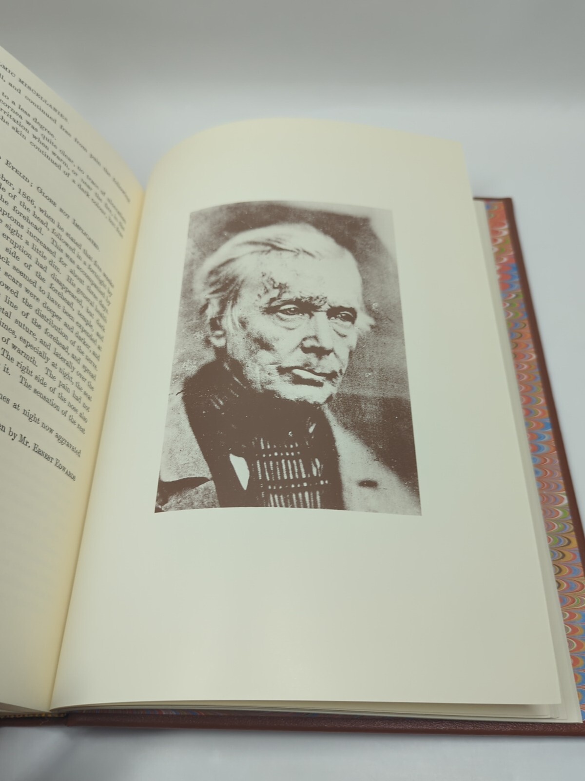 The Collected Papers Sir William Bowman 1984 Classics Ophthalmology Library