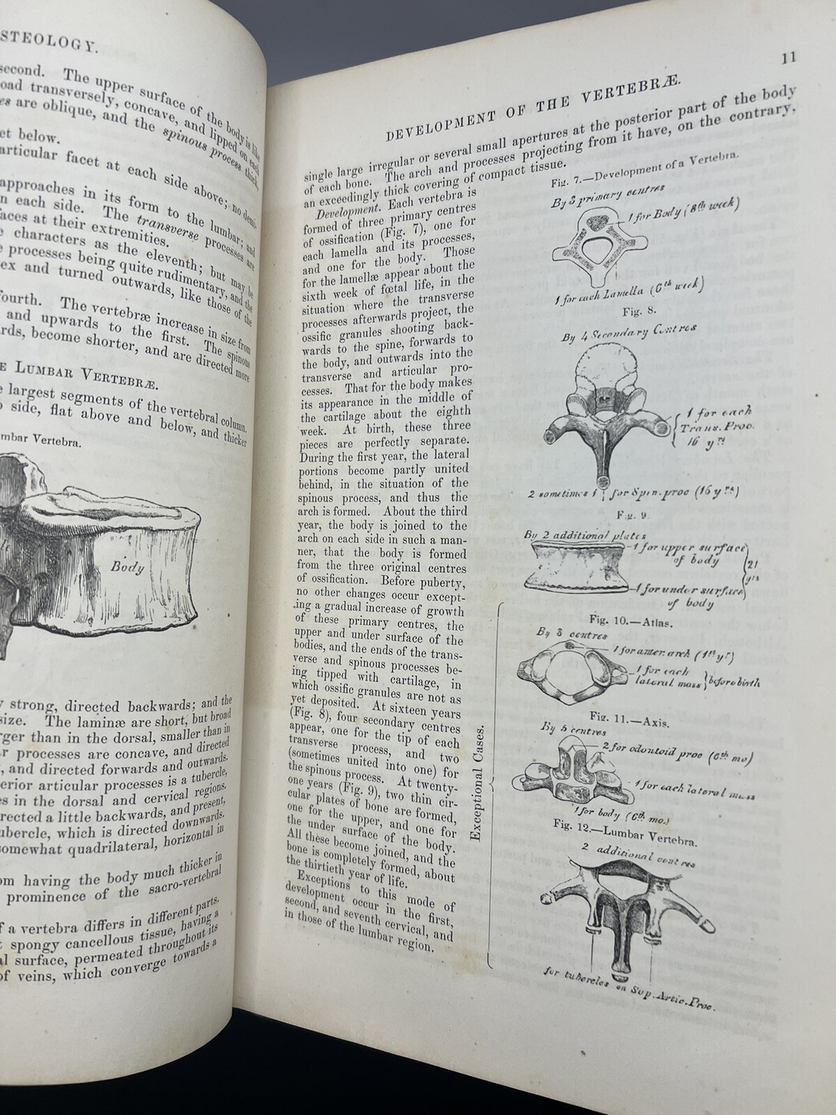 “Gray’s Anatomy” Anatomy Descriptive and Surgical By Henry Gray 1859