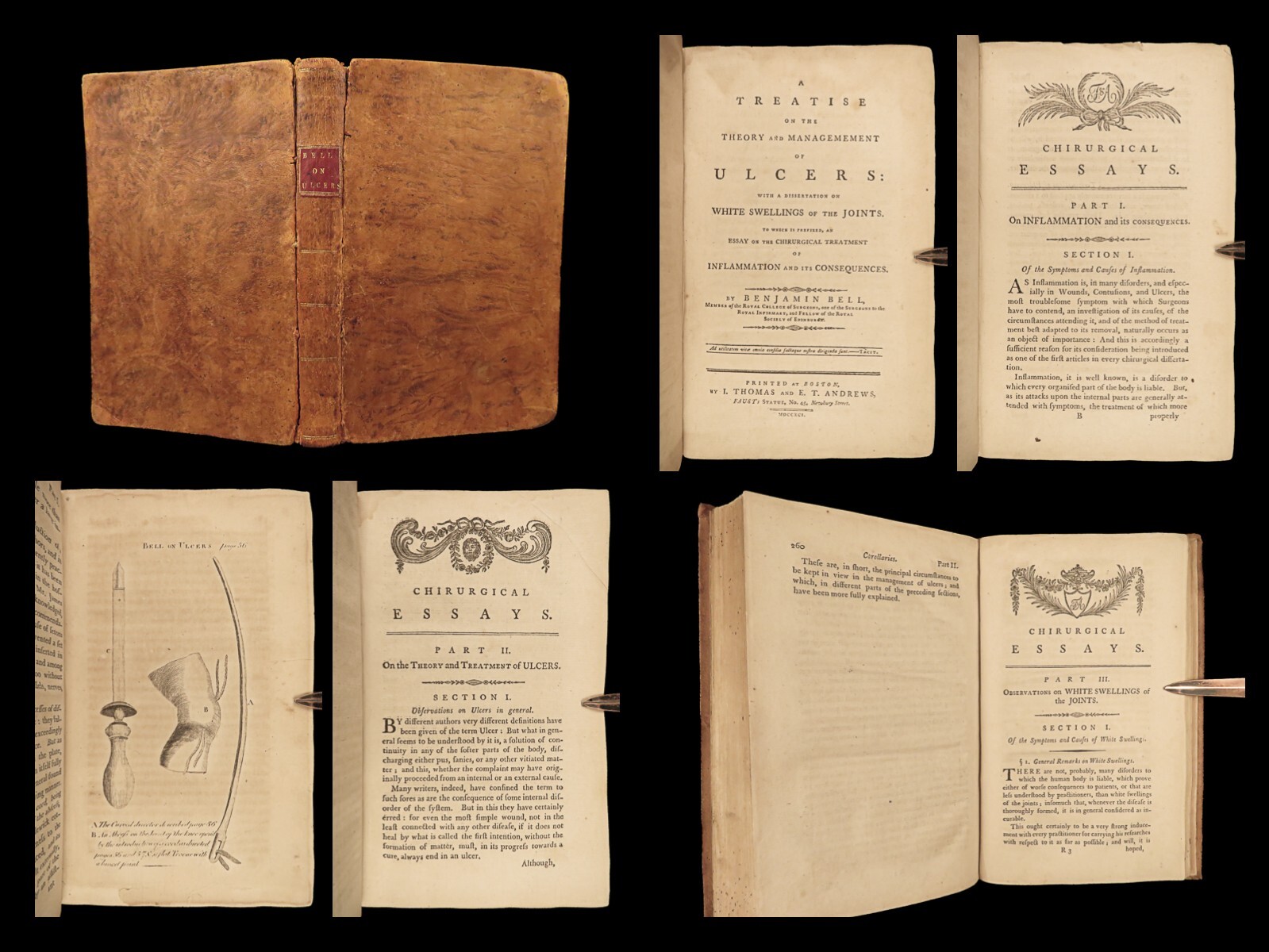 1791 Boston USA Medicine 1ed Benjamin Bell ULCERS Inflammation Gangrene Sores