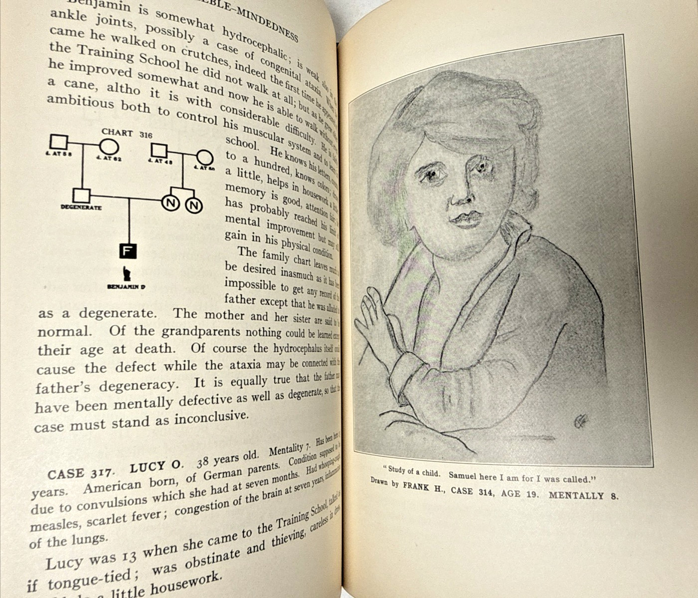Feeblemindedness Causes Consequences Goddard 1926 Genetics Antique Medical Book