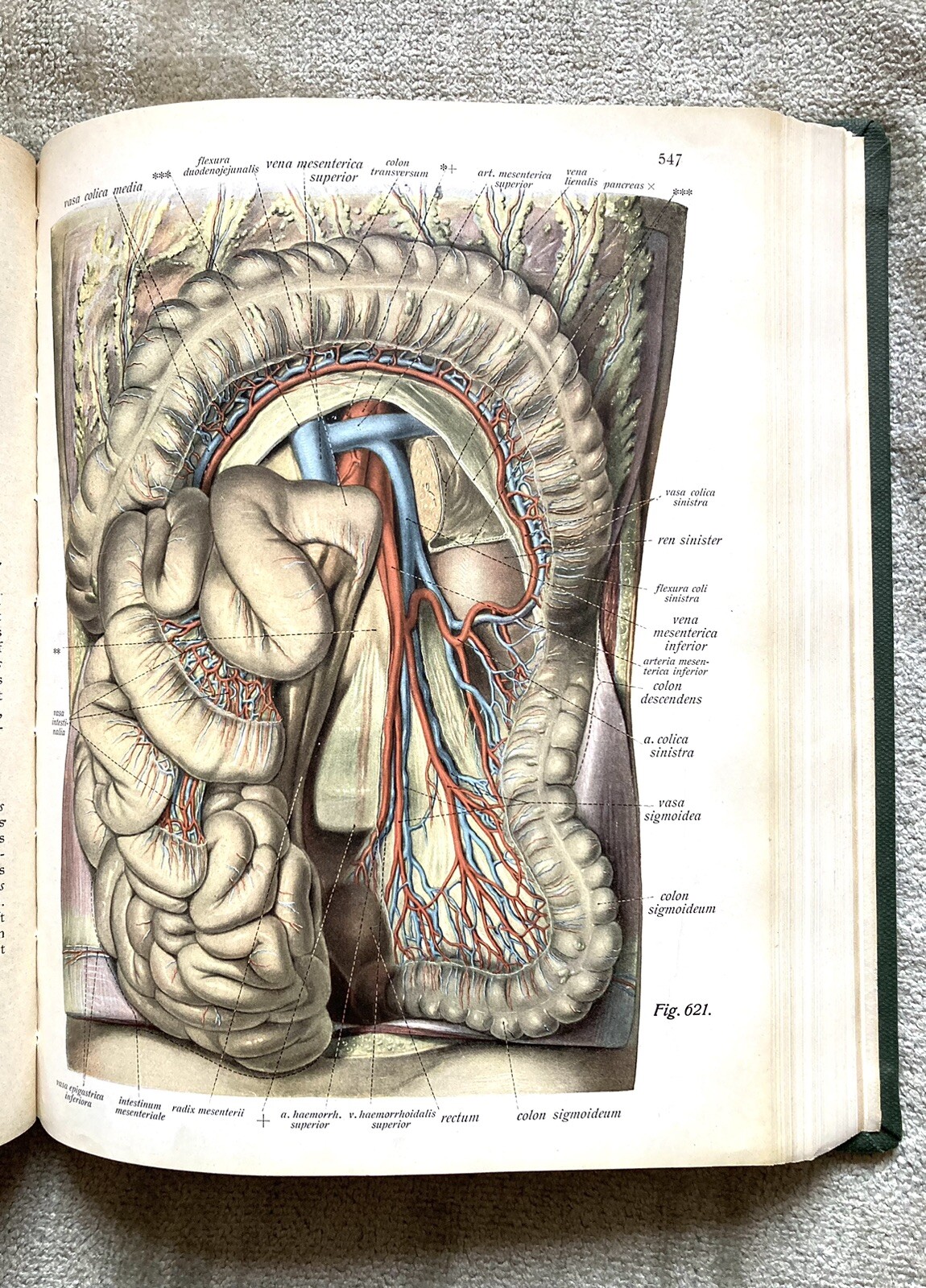 Atlas Of Human Anatomy, Antique, 3 Volumes, Complete Set, 1930, Good+ Condition