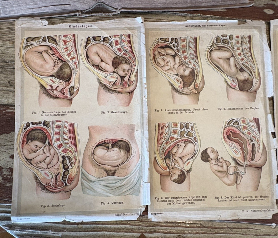 Antique Bilz Supplement-Band Interactive Anatomical Flap Book c1905–1912 Leipzig
