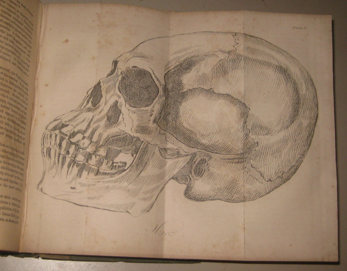 1840 Lectures on Comparative Anatomy Physiology Zoology Natural History of Man