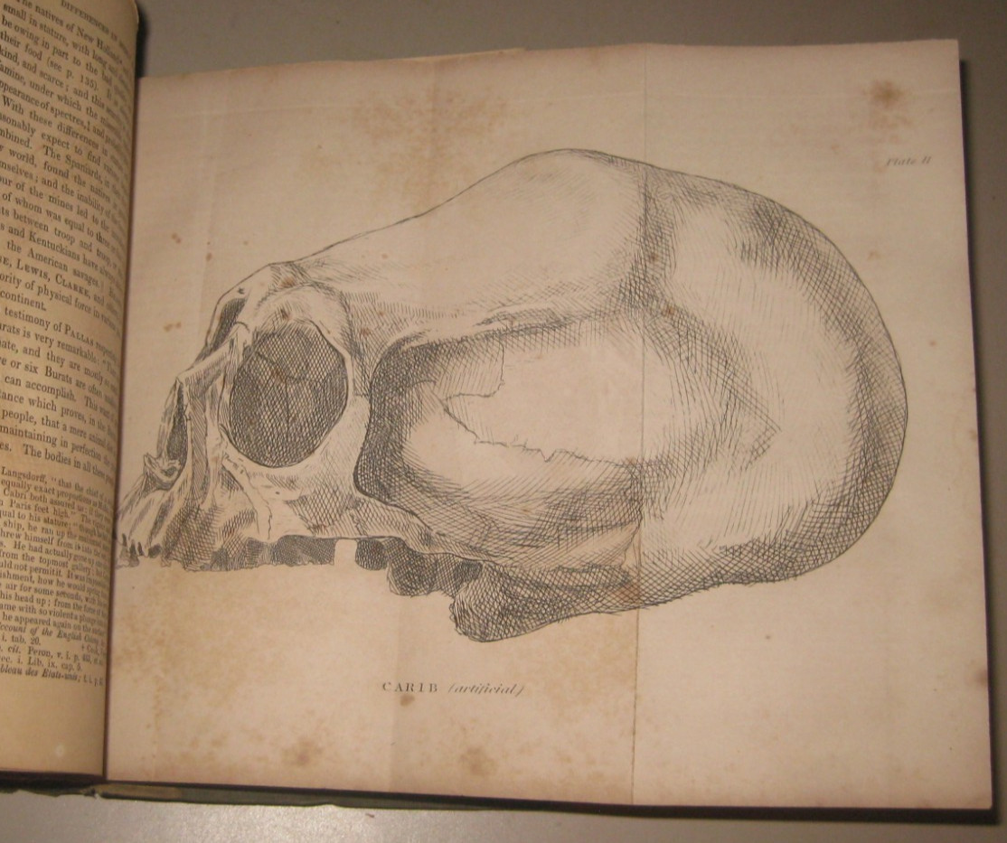 1840 Lectures on Comparative Anatomy Physiology Zoology Natural History of Man