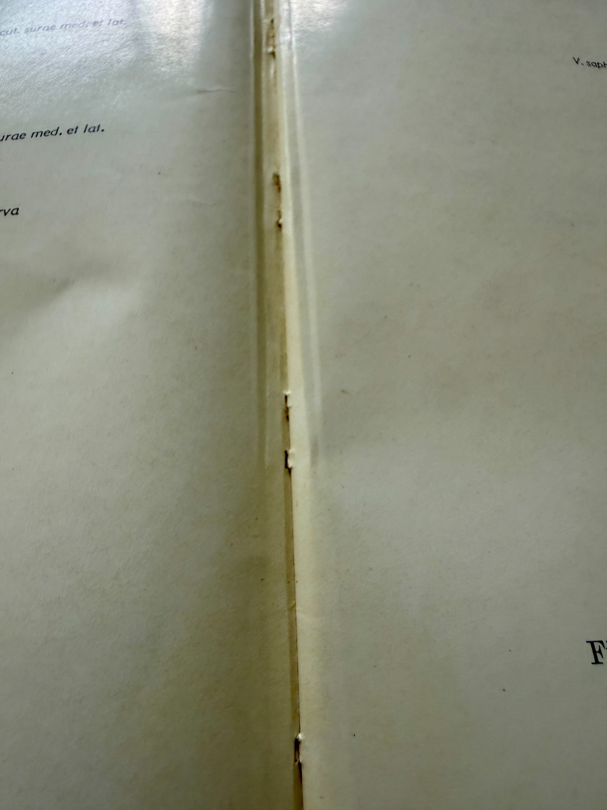 Pernkopf Atlas Topographical Applied Human Anatomy Vol 2 1964 W.B. Saunders