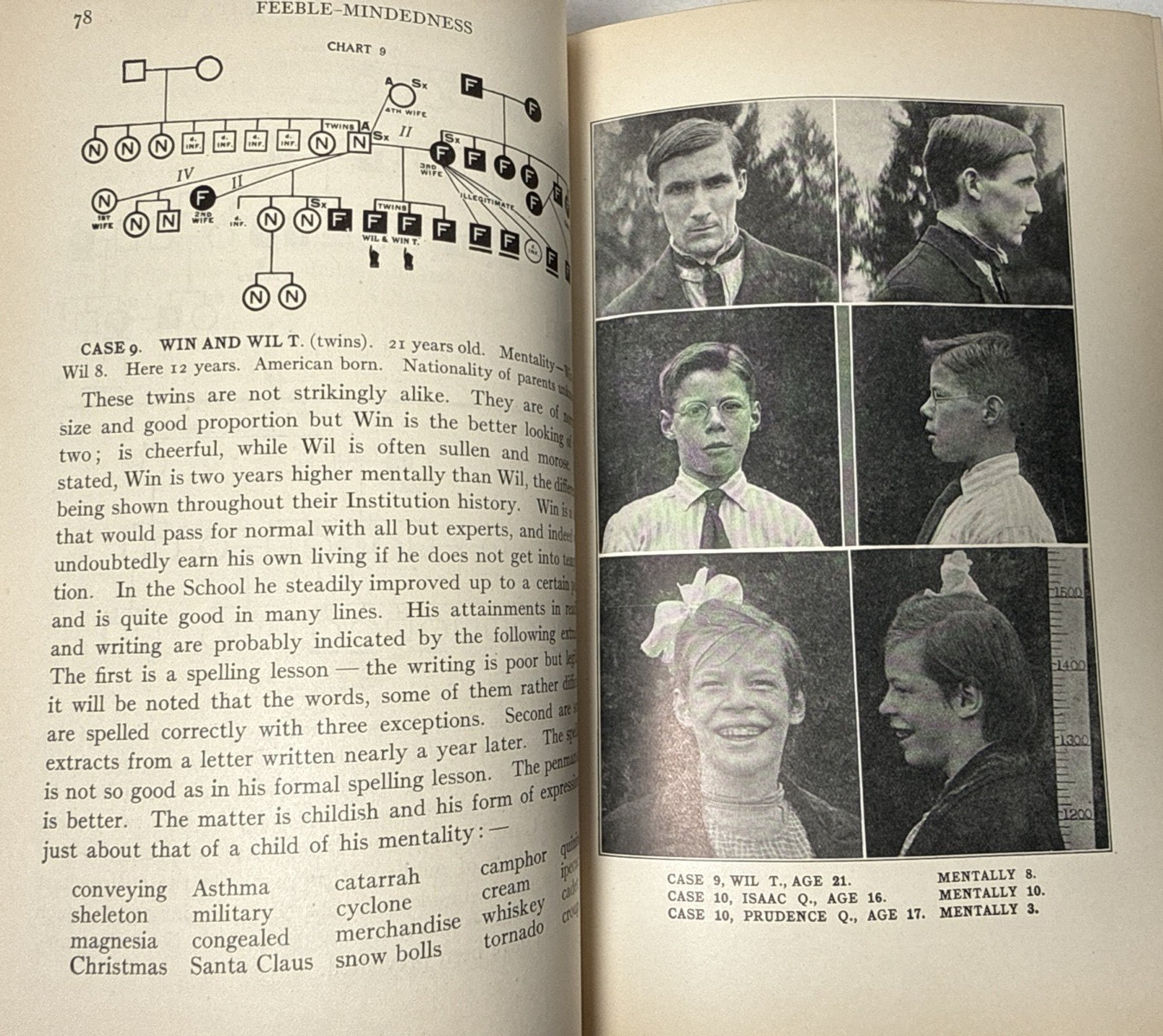 Feeblemindedness Causes Consequences Goddard 1926 Genetics Antique Medical Book