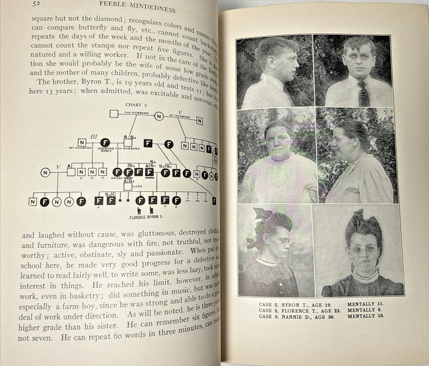 Feeblemindedness Causes Consequences Goddard 1926 Genetics Antique Medical Book