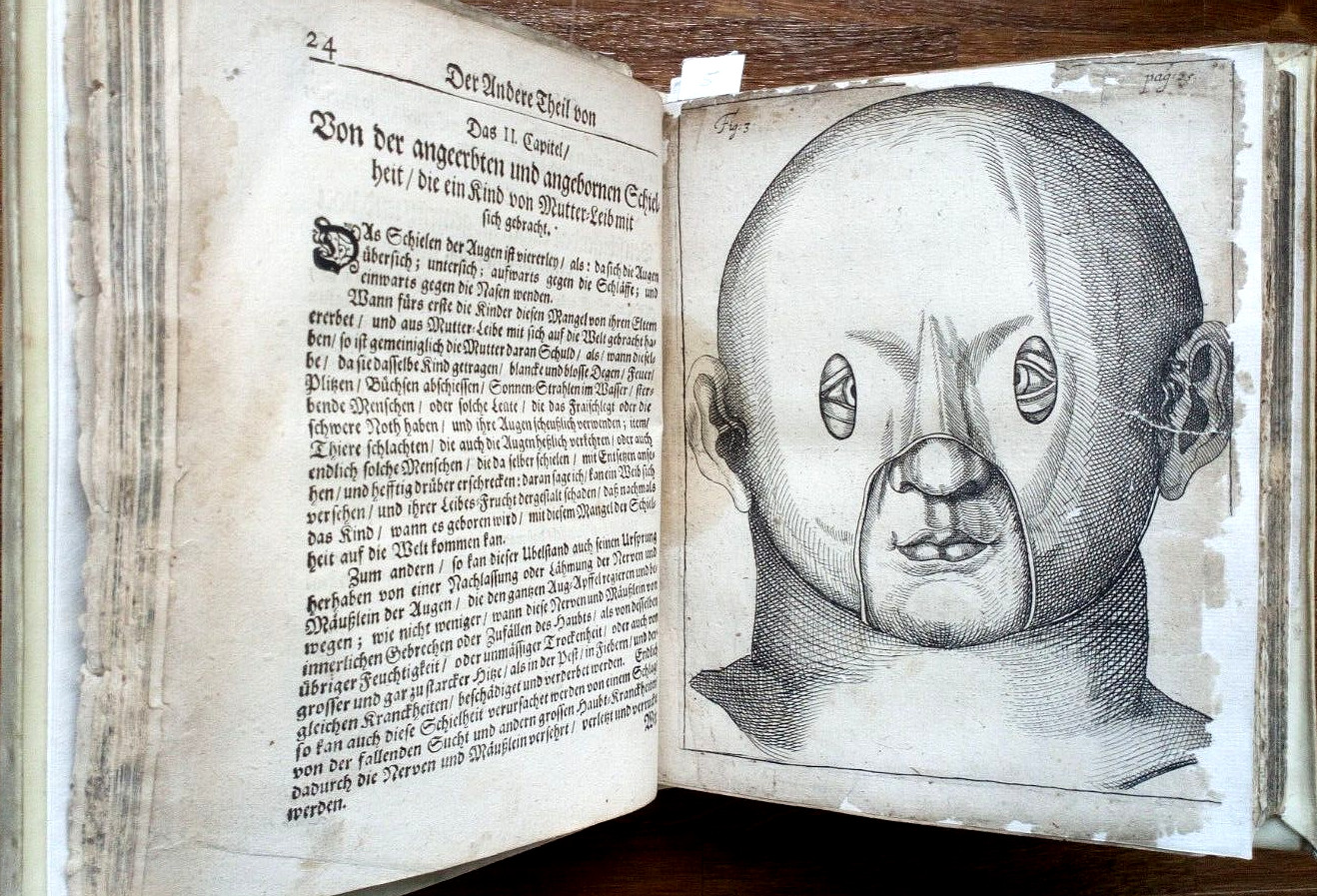 ? George Bar Table: OPHTHALMODULEIA – EYE SERVICE. 2 edition. 1686 Sulzbach RARE!