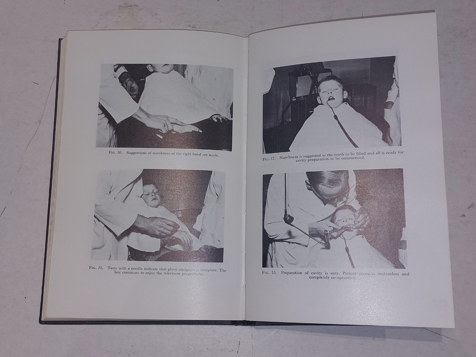 Hypnosis in General Dental Practice By Thomas W Frost (1959) Hb Book
