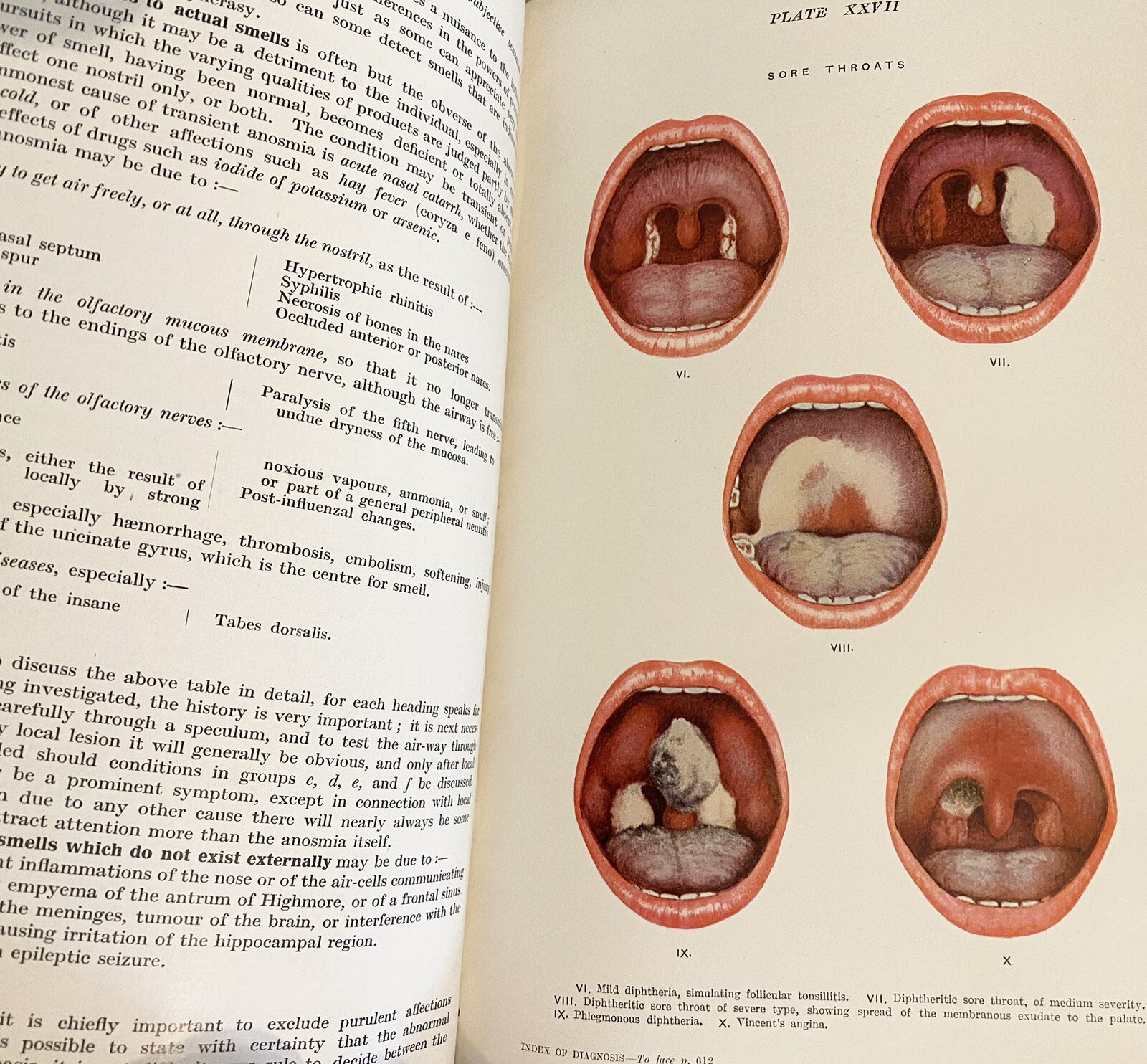 RARE VG+ Index Differential Diagnosis Ed French 1923 Antique Medical Book Illus
