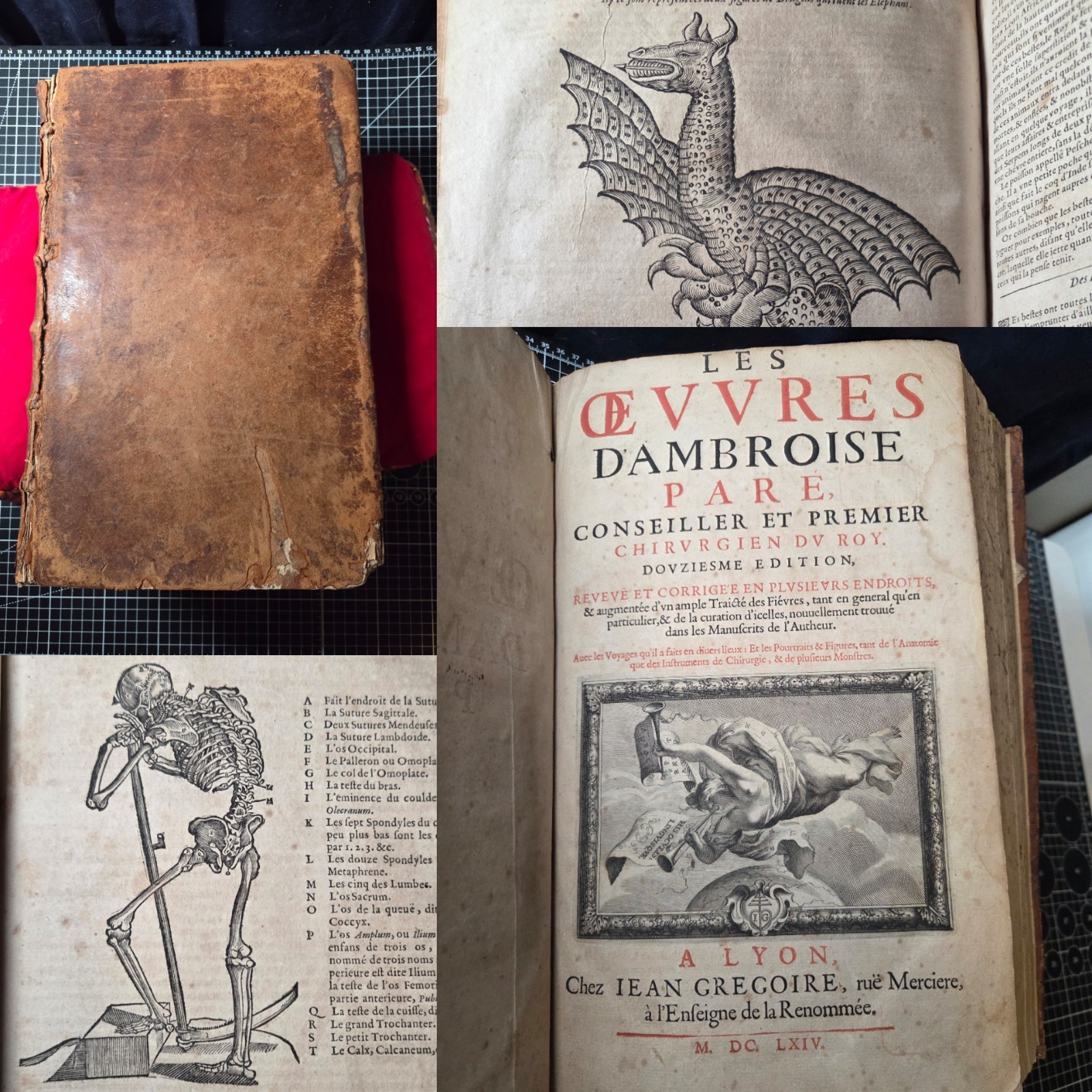 Les Oeuvres d’Ambroise Pare 1664 ~ Hundreds of Woodcuts ~ Surgery and Monsters